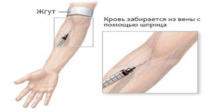 Hemoglobina și normalizarea ei, industria sănătății