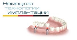 Implanturile israeliene au o dentară, o diomedes