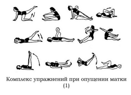 Yoga la scăderea uterului este o intuiție a femeii