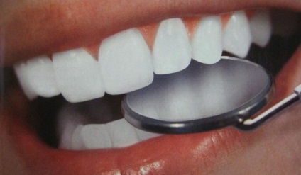 Cum să vă albiți rapid dinții fără a vă face rău acasă