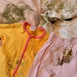 Cum să spălați mucegaiul de la haine la domiciliu alegeți cel mai bun remediu