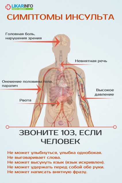 Cum să recunoașteți primele semne de accident vascular cerebral și să oferiți primul ajutor