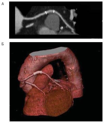 Cardiologic Herald