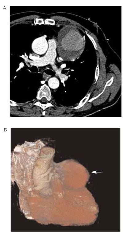 Cardiologic Herald