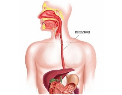 Ezofagită catarală care sunt simptomele și cum se tratează boala