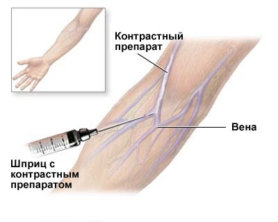 Tomografia computerizată a cavității abdominale, a inimii, a vaselor cerebrale, a copiilor, a indicațiilor și a