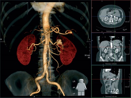 Tomografia computerizată a cavității abdominale, a inimii, a vaselor cerebrale, a copiilor, a indicațiilor și a