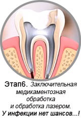 Tratamentul canalului rănilor, 32