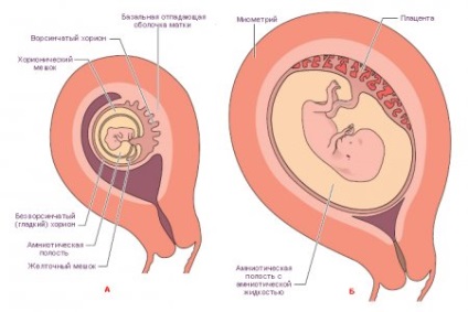Localizarea corionului în timpul sarcinii