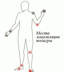 Metode de tratare a gută la domiciliu - case și ziduri de ajutor