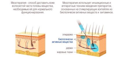 Mezoterapia pentru procedurile foto și video pentru păr, recenzii ale clienților