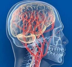 Încălcarea circulației cerebrale în osteochondroza cervicală