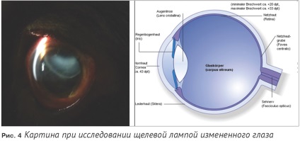 Despre cercetarea oftalmologică