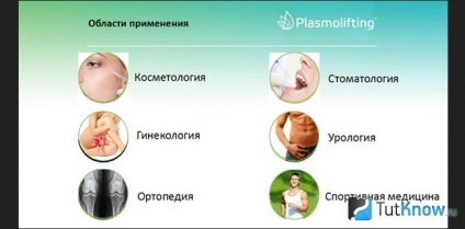 Caracteristicile procedurii plasmolifting