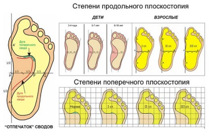 Защо боли петата страна на вътрешната страна на крака