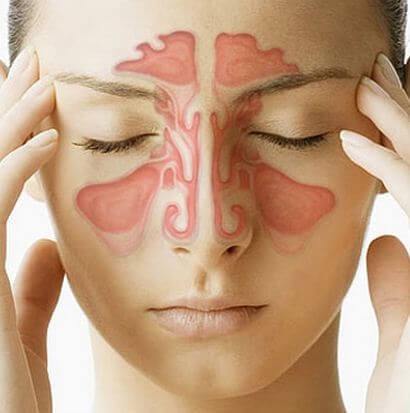 Polipi în simptomele nasului, diagnostic, tratament
