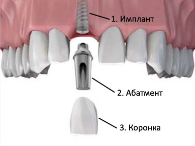 Beneficiile și importanța stomatologiei chirurgicale - stomatologie a lui Lukașuk