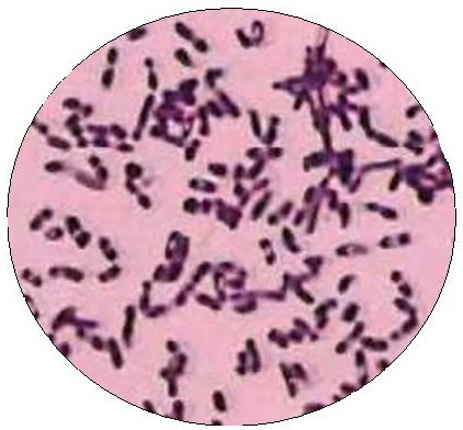 Prevenirea pseudotuberculozei