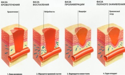 класификация рана