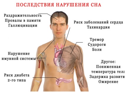 Нарушения на съня при децата симптоми, лечение, профилактика, причините за болестта