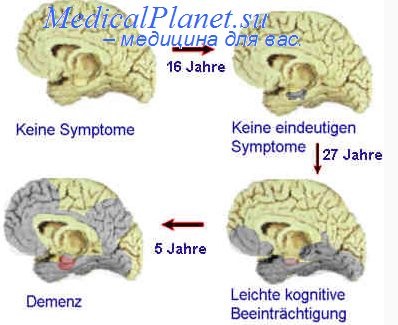 Reglarea funcțiilor cognitive