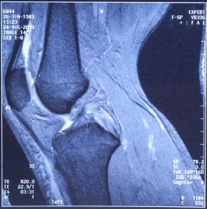 X-ray, tomografie computerizată (kt), mrt în tskb №6