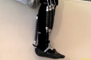 Proteza robotică va schimba reabilitarea modernă, nu - nu vom fi prinși