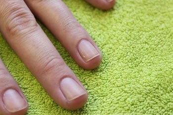 Degetele și fracturile de unghii reprezintă metode eficiente de combatere a delaminării unghiilor