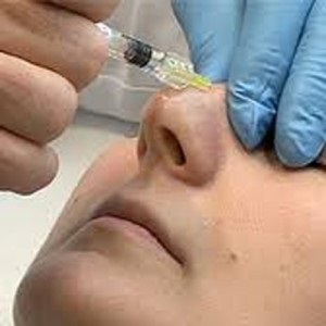 Injecțiile diprospanului după rinoplastie - recenzii, rinoplastia nasului