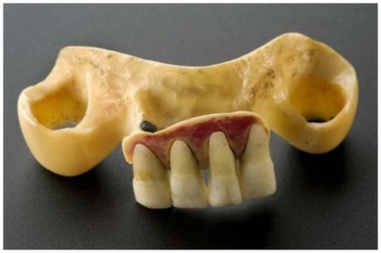 Horror, középkori fogászat, ahonnan már nem félnek a fogorvos - a keresési