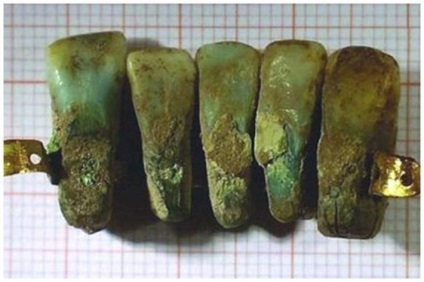 Ororile stomatologiei medievale, de la care vei înceta să te temi de dentistul tău - căutarea mea
