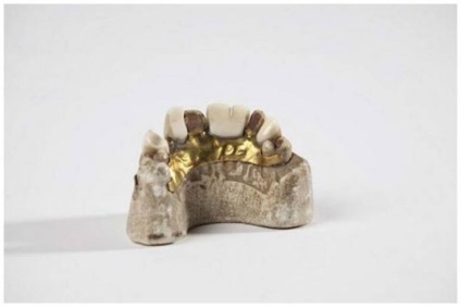 Ororile stomatologiei medievale, de la care vei înceta să te temi de dentistul tău - căutarea mea