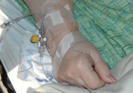 Într-un spital sub pacientul rău, în loc de accident vascular cerebral, o migrenă a fost diagnosticată într-o știre de comă