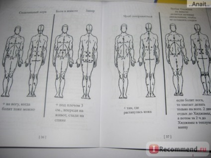 Hijama - sânge capilare - 