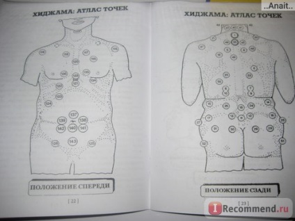 Hijama - sânge capilare - 