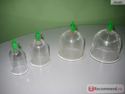 Hijama - sânge capilare - 