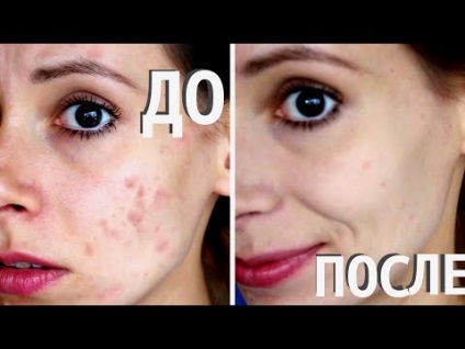 Afectează cosmeticele iherb - uhodovaya