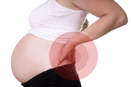Strângerea nervului sciatic în timpul sarcinii - tratament, simptome, unguente