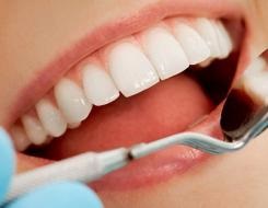 100 Metode de curățare a dinților