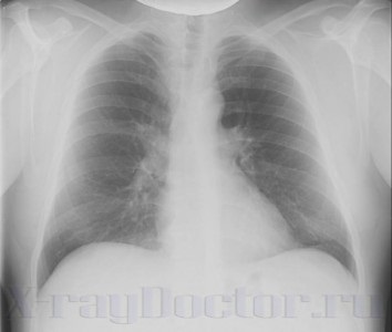 7 X-ray chest cu descrieri
