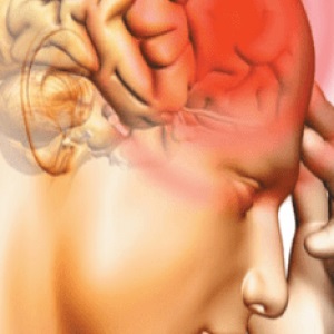 Chistul arahnoid al creierului provoacă și tratamentul