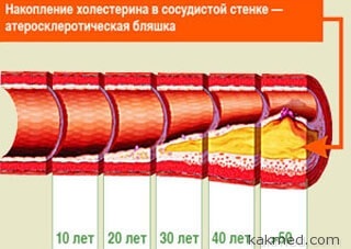 Curățarea vaselor cu usturoi și lămâie