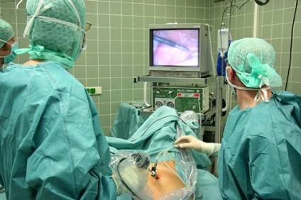 Ce este laparoscopia ovarelor și la care este prezentată