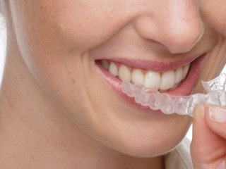 Acasa albirea dintilor poate fi nereusita, intrarea la medicul dentist