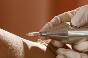 Carboxyterapia (injecții de gaz) pentru indicații spate și articulare, recenzii