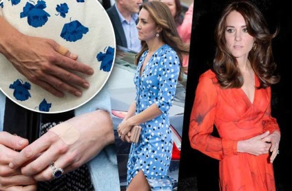 Kate Middleton este bolnavă de bulimie