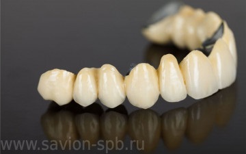 Coroane ceramice metalice pe dinti, pret cermet in spb