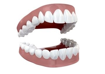 Molars dinți