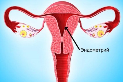 Lehet endometriózis rákká fejlődik továbbítjuk