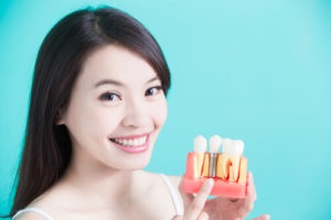 Extinderea dinților - etanșare, coroane, furnire, implantare